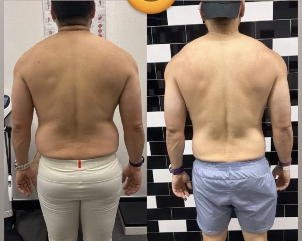 before and after fat loss transformation London female client weight loss personal trainer Zack Fitness